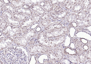 Phospho-PTPN11 (Tyr511) Rabbit Polyclonal Antibody