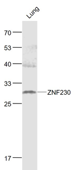 RNF141/ZNF230 Rabbit Polyclonal Antibody
