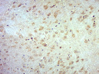 PANK1 Rabbit Polyclonal Antibody