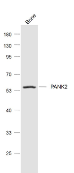 PANK2 Rabbit Polyclonal Antibody