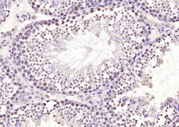 Ube2N Rabbit Polyclonal Antibody