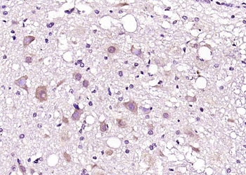 LRRC59 Rabbit Polyclonal Antibody