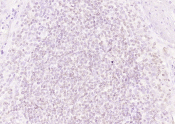 LRRC41 Rabbit Polyclonal Antibody