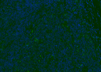 CD8B Rabbit Polyclonal Antibody