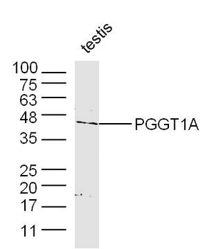 PGGT1A Rabbit Polyclonal Antibody