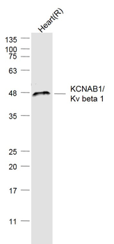 KCNAB1/Kv beta 1 Rabbit Polyclonal Antibody