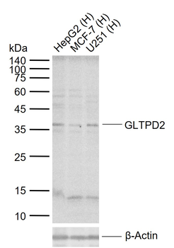 GLTPD2 Rabbit Polyclonal Antibody