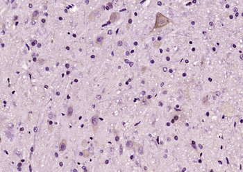 C6orf120 Rabbit Polyclonal Antibody