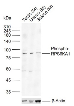 p90RSK (phospho-Thr573) antibody