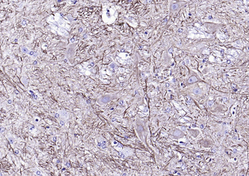 NF-L Mouse Monoclonal Antibody