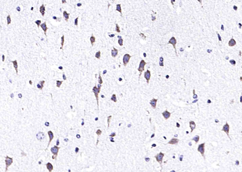 ADAM10 Rabbit Polyclonal Antibody