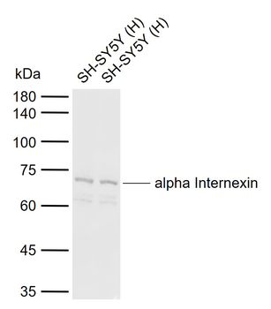 Alpha Internexin Rabbit Polyclonal Antibody