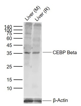 CEBP Beta antibody