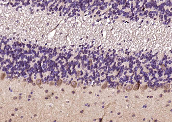 ANKS6 Rabbit Polyclonal Antibody