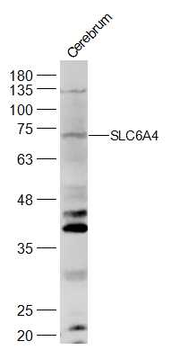 Serotonin transporter Rabbit Polyclonal Antibody