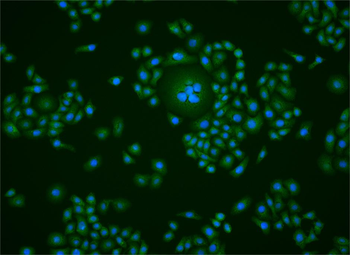 ABCF1 Rabbit Polyclonal Antibody