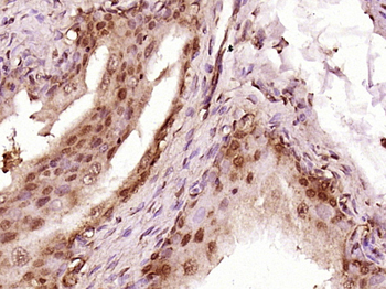 ABCF1 Rabbit Polyclonal Antibody