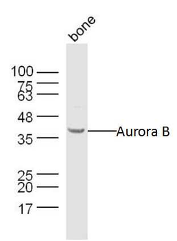 Aurora B Rabbit Polyclonal Antibody