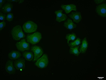 PDCD1LG2 Rabbit Polyclonal Antibody