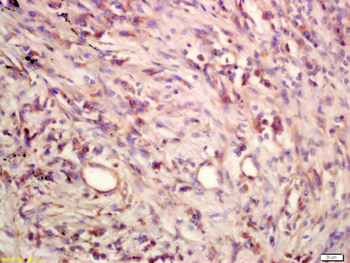 CCL27 Rabbit Polyclonal Antibody