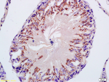 CYP21A2 Rabbit Polyclonal Antibody