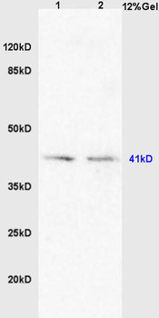 Dopamine D4 receptor Rabbit Polyclonal Antibody