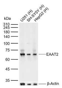 EAAT2 Rabbit Polyclonal Antibody