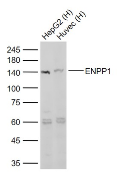 ENPP1 Rabbit Polyclonal Antibody