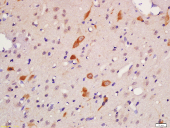 EPH receptor A4 Rabbit Polyclonal Antibody