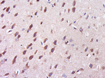 FABP7 Rabbit Polyclonal Antibody
