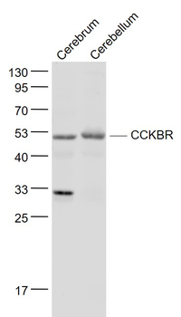 CCKBR Rabbit Polyclonal Antibody