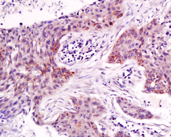 NAP2 Rabbit Polyclonal Antibody