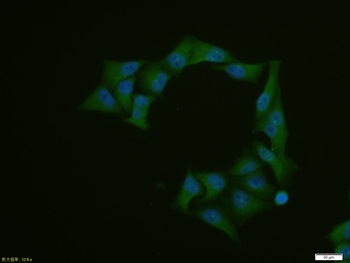 GLK Rabbit Polyclonal Antibody