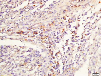 GNLY Rabbit Polyclonal Antibody