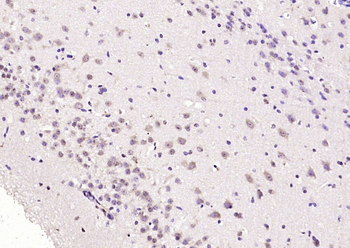 RGS4 Rabbit Polyclonal Antibody