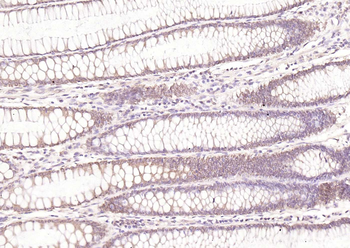 HDAC2 Rabbit Polyclonal Antibody