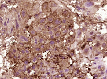 IL-15 Rabbit Polyclonal Antibody