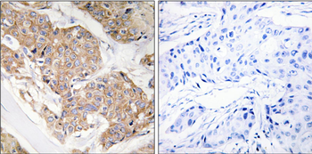 IL13RA1 Rabbit Polyclonal Antibody