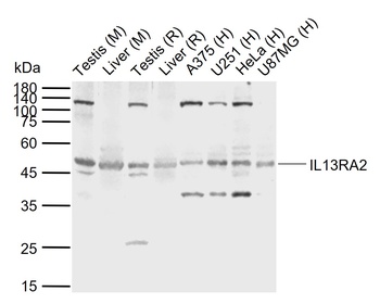 alpha 2 IL13 Receptor antibody