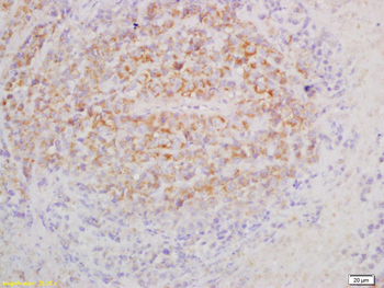 IL3RA Rabbit Polyclonal Antibody
