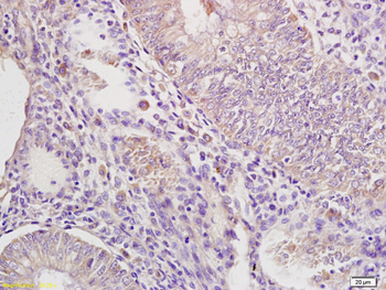 IRAK4 Rabbit Polyclonal Antibody