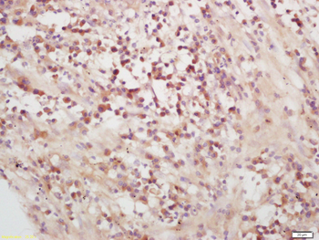 IRAK4 Rabbit Polyclonal Antibody