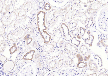 SLC2A4RG Rabbit Polyclonal Antibody