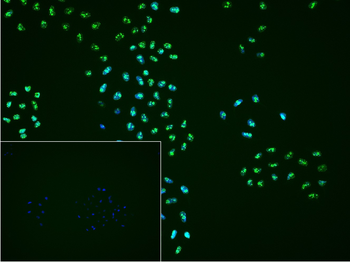 Ki-67 Rabbit Polyclonal Antibody