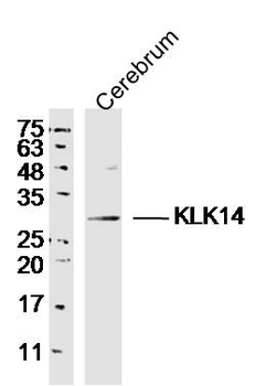 KLK14 Rabbit Polyclonal Antibody