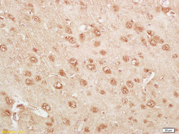 KLK14 Rabbit Polyclonal Antibody