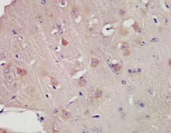 KCNC3 Rabbit Polyclonal Antibody