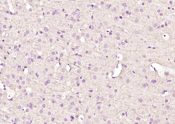 GABA A Receptor alpha 3 Rabbit Polyclonal Antibody