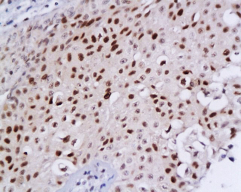 MCM2 Rabbit Polyclonal Antibody