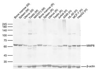 MMP8 Rabbit Polyclonal Antibody